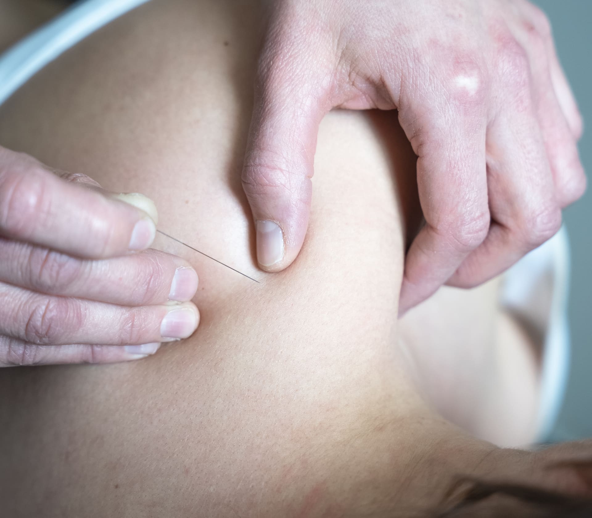 Myofasciale therapie bij Kinovate